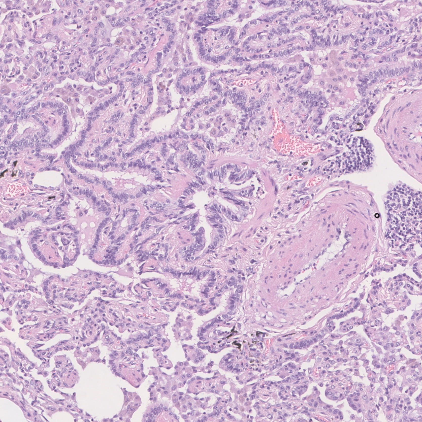 Ensino | FMUP abre candidaturas para a 1.� edi��o do curso �Doen�as Pulmonares Difusas�